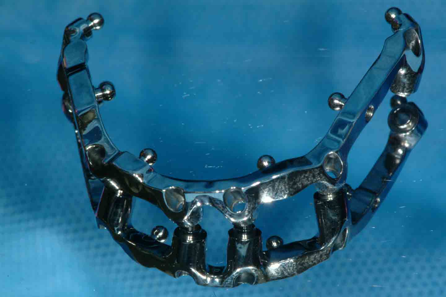 Photo de prosthodontie